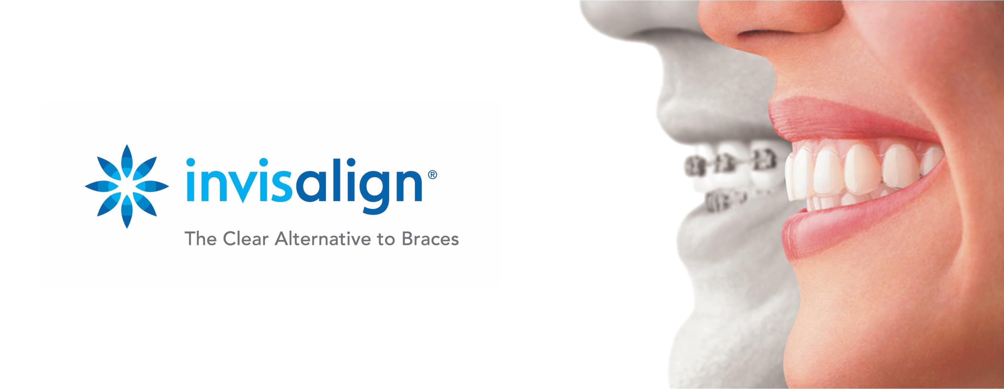 Invisalign-1-page-001